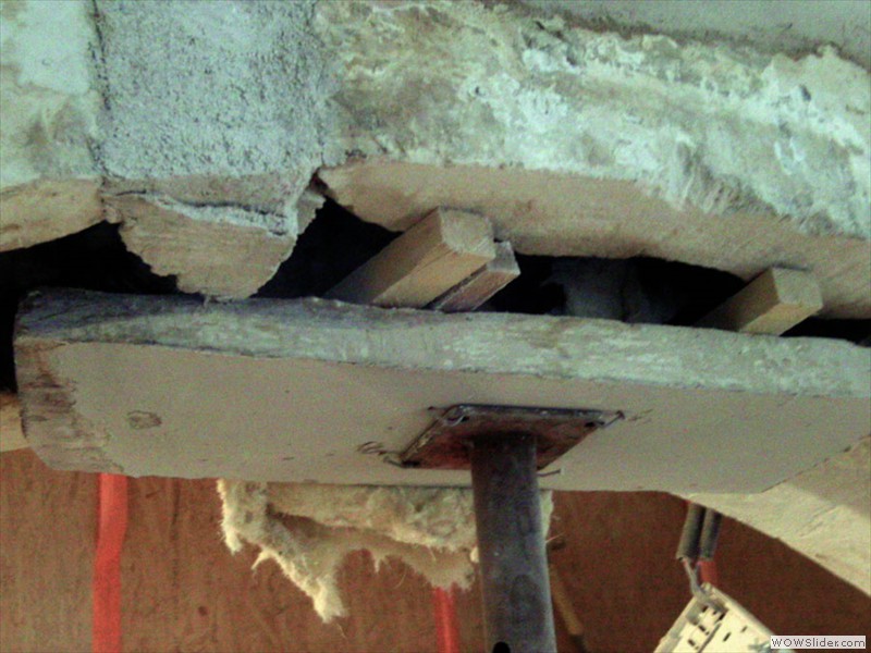 Restructuration clé de voute